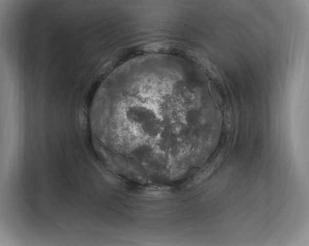 X0000112020375200908171435