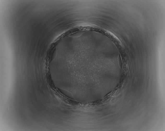 X0000112020775200908171429