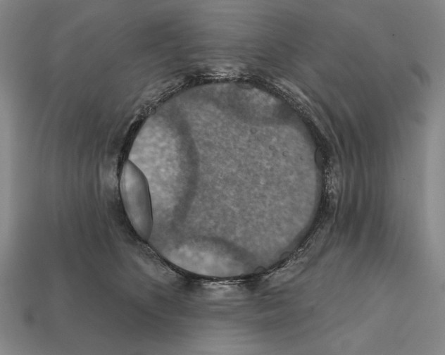 X0000112020516200909141038