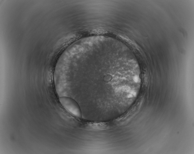 X0000112020517200909141038