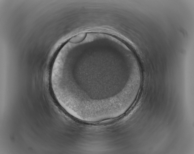 X0000112021506200909141025