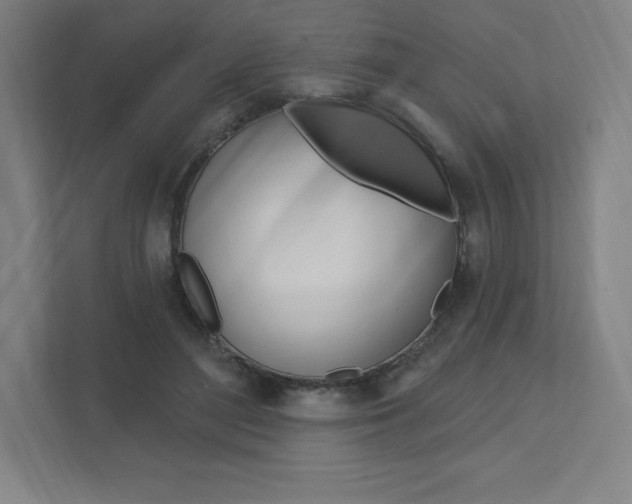 X0000112030500200908031025
