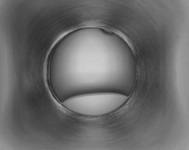 X0000112031147200908031017