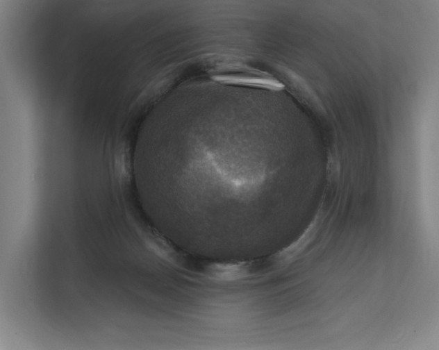 X0000112030170200908171458