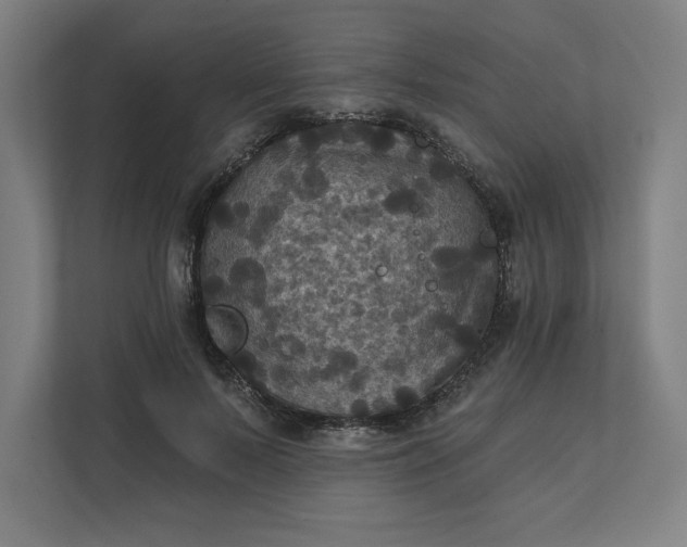 X0000112030695200908171451