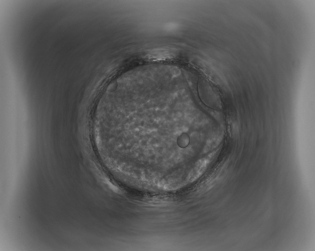 X0000112031393200908171441
