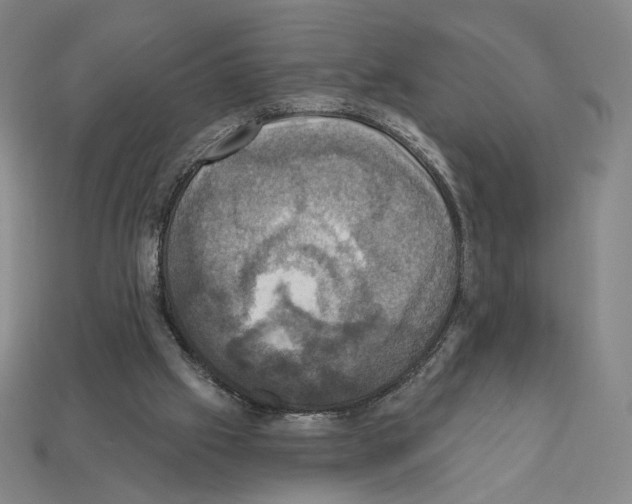 X0000112030057200909141105