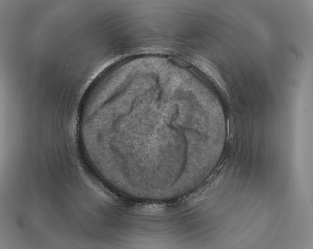 X0000112030156200909141104