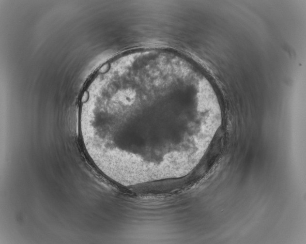 X0000112031171200909141050