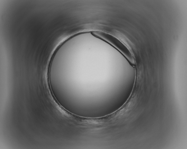 X0000112041197200908031036