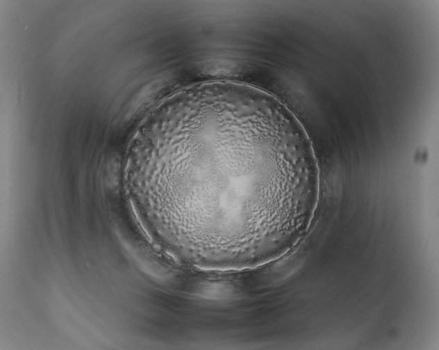X0000112040175200908031525