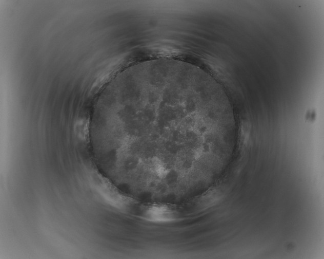 X0000112040177200908031525