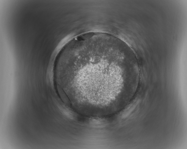 X0000112040199200908171518