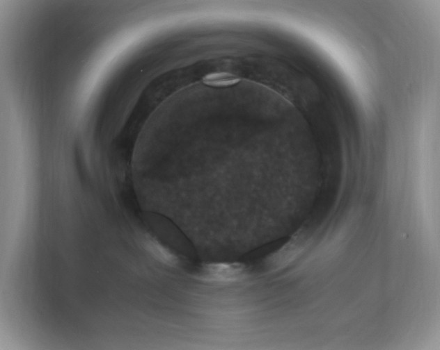 X0000112040239200908171517
