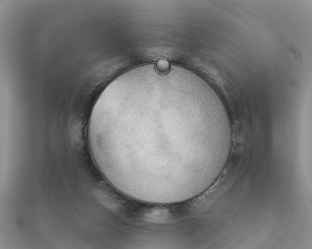 X0000112060162200908111419