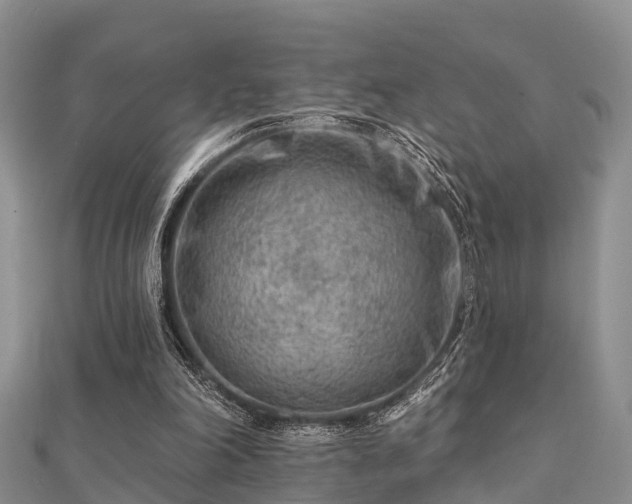 X0000112060198200908111419