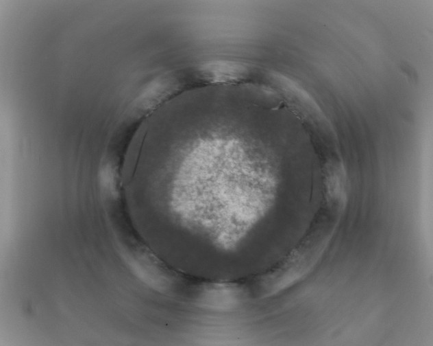 X0000112060316200908111417