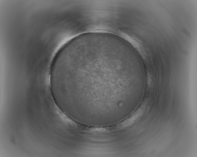 X0000112061462200908111401