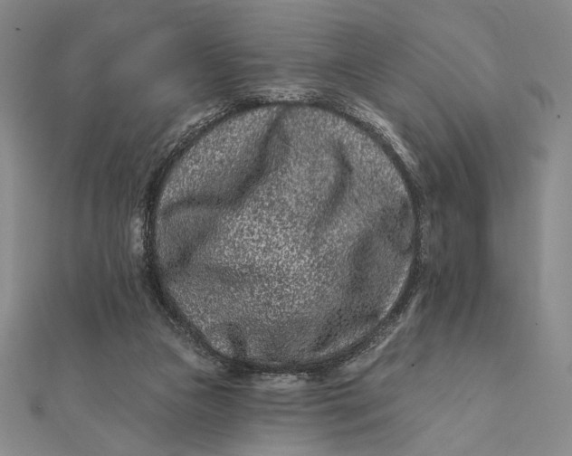 X0000112060161200908251029