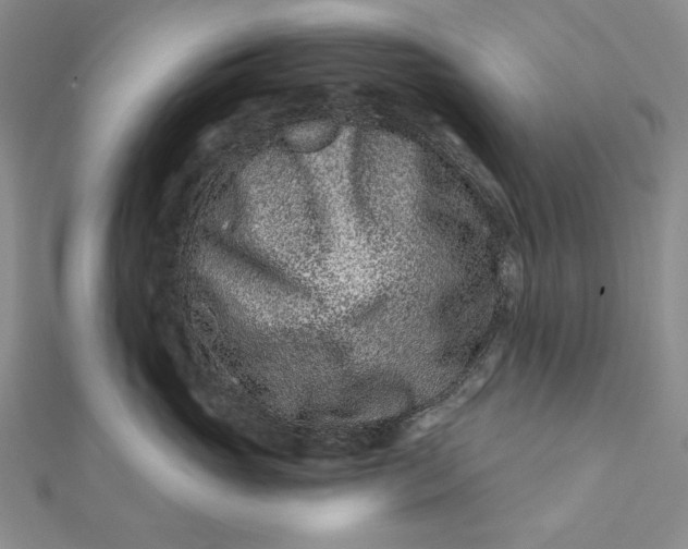 X0000112060765200908251021