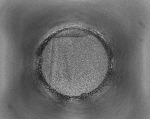 X0000112111496200908251200