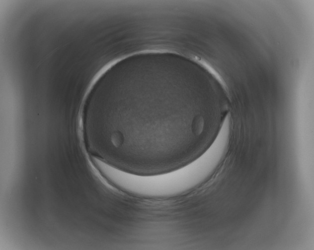 X0000112151468200908141205