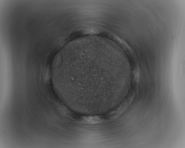 X0000112160517200908211437