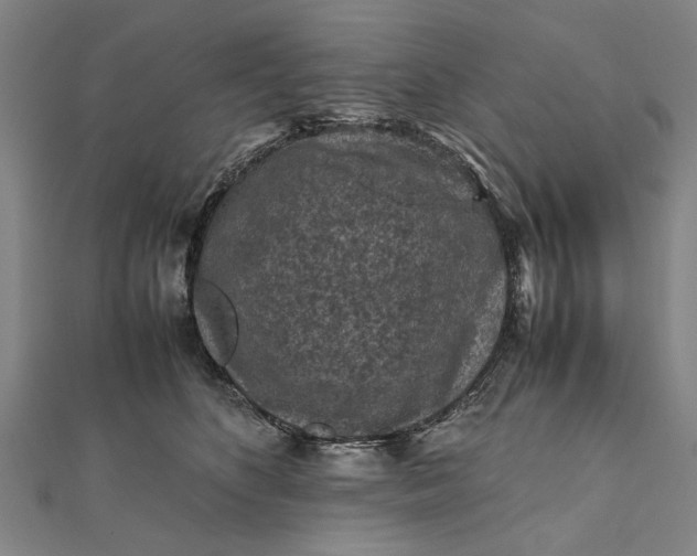 X0000112170516200908211429