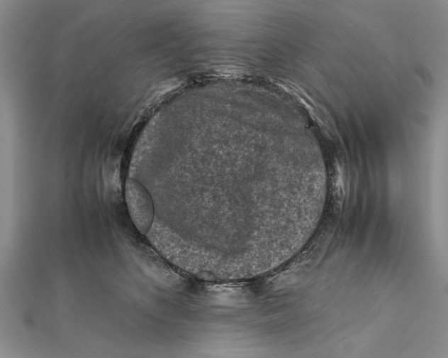 X0000112170516200908281342