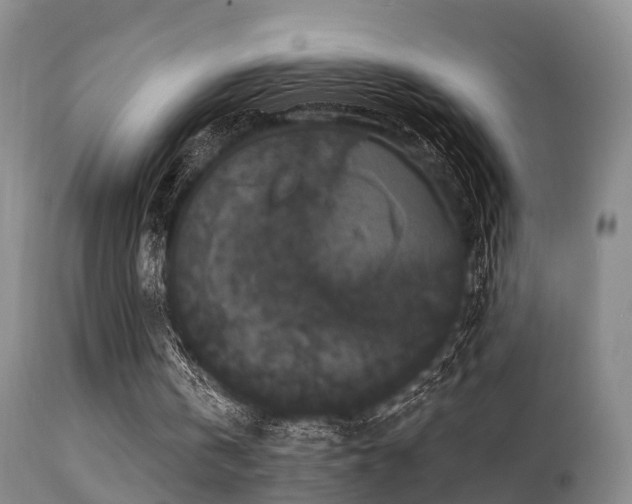 X0000112200146200908141442