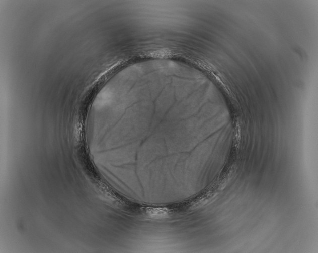 X0000112200355200909181538