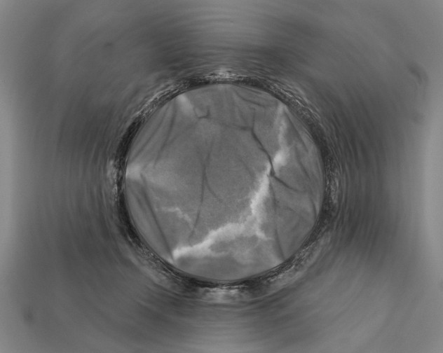 X0000112200366200909181538