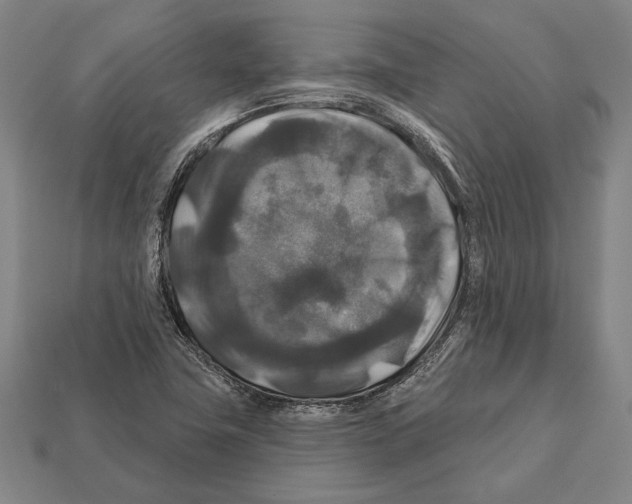 X0000112201411200909181524