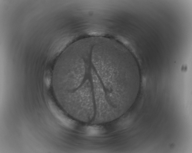 X0000112210069200908141508