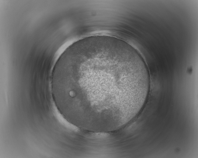 X0000112211090200908141452