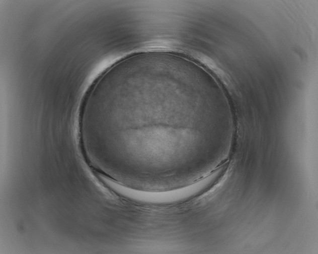 X0000112351469200908131418