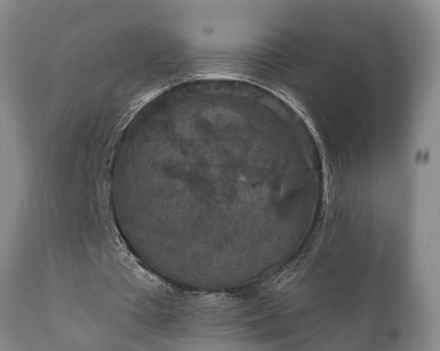 X0000112350385200908201445