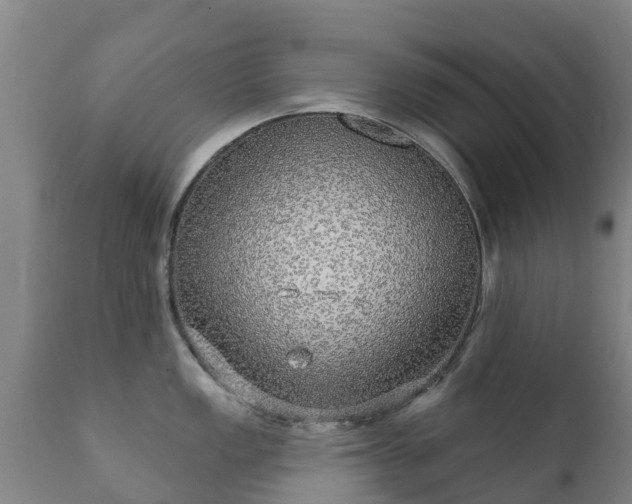 X0000112361149200908201457