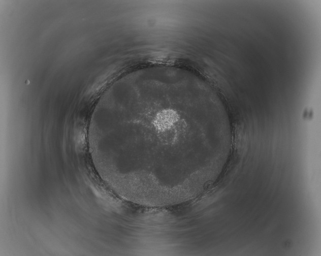 X0000112361154200908201456