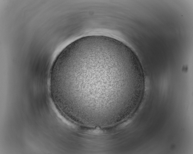 X0000112361517200908201451