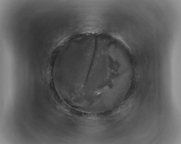 X0000112361399200908271244