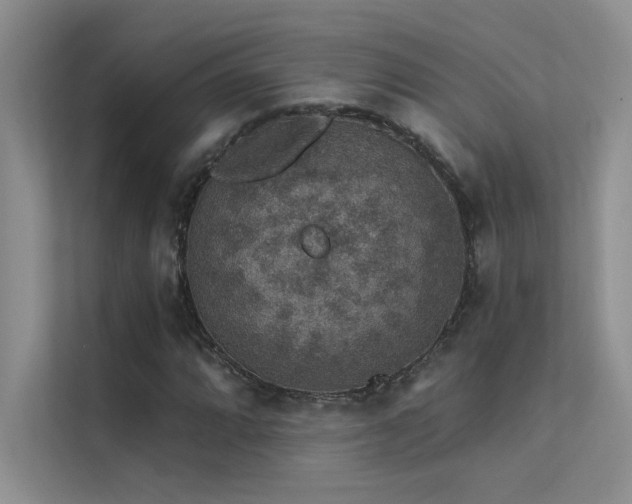 X0000112381064200908131524