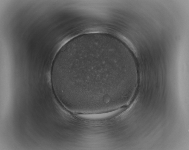 X0000112381465200908131519