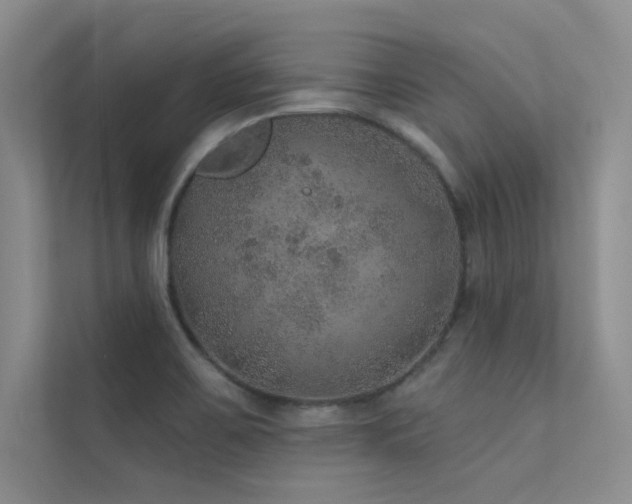 X0000112381467200908131519