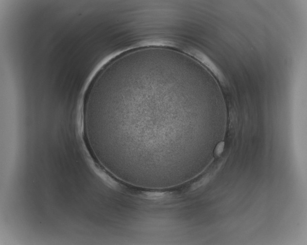 X0000112381132200908201517