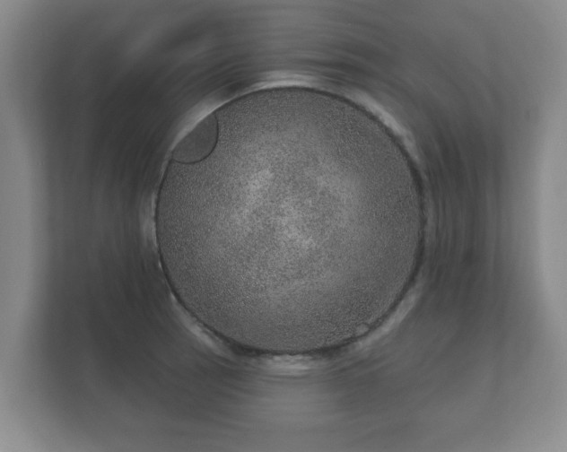 X0000112381137200908201517