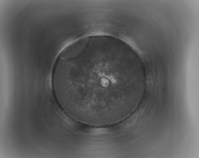 X0000112381173200908201516