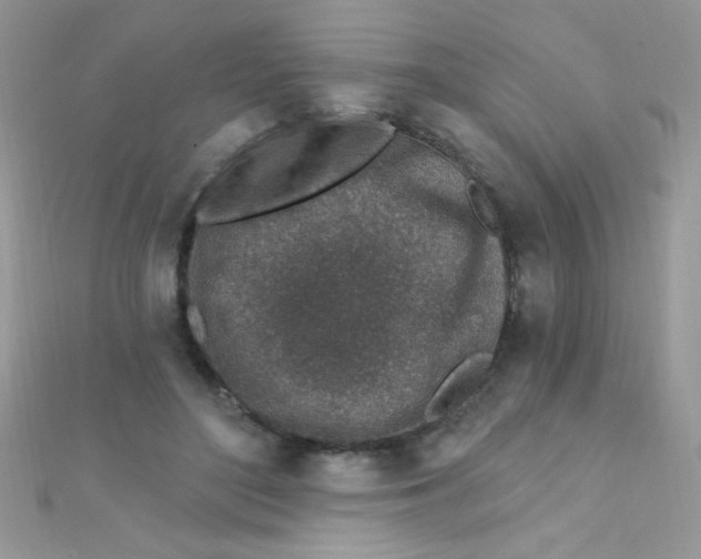 X0000112390500200909032017