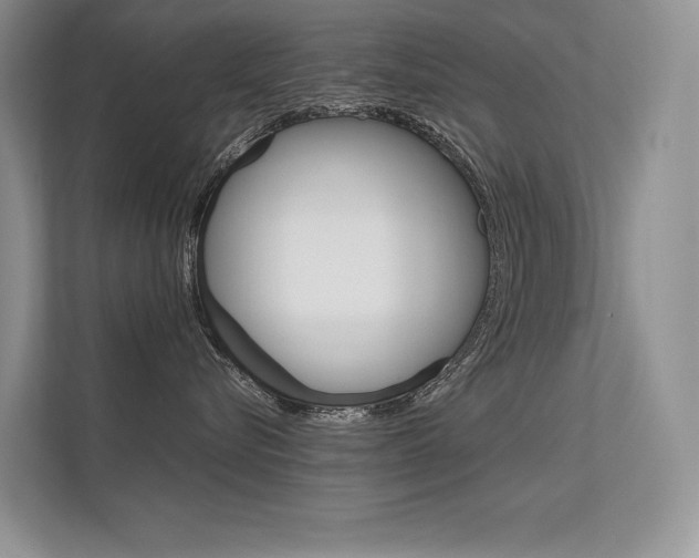 X0000112400576200908141008