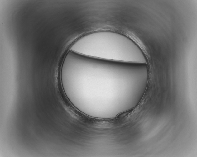 X0000112410058200908141034